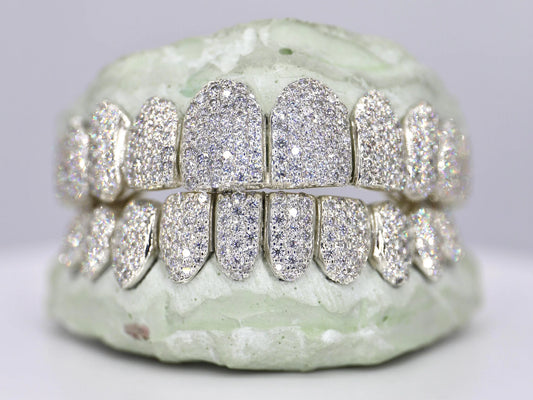 10 on 10 VVS Moisannite Diamond Grillz