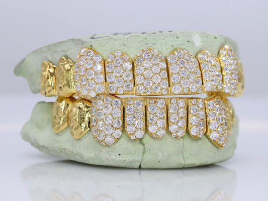10 on 10 Jumbo Double Rose Cut Cap VVS Moissanite Diamond Grillz